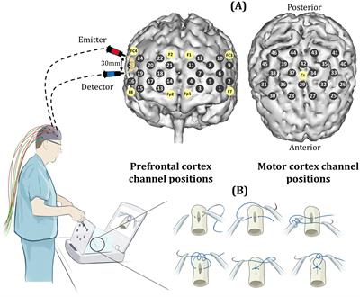 Investigating the impact of mental rehearsal on prefrontal and motor cortical haemodynamic responses in surgeons using optical neuroimaging